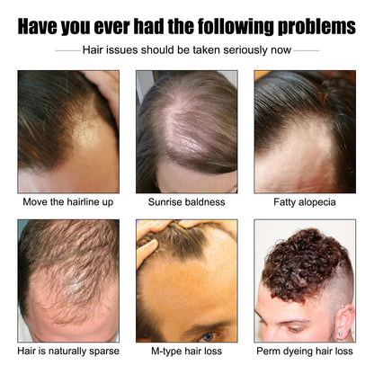 Vitamin E Hair Growth Oil – Baldness Prevention and Hair Repair